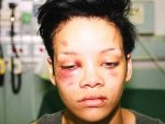 Rihannayı Dövmenin Cezası Temizlik